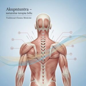 Czy akupunktura pomaga na bóle głowy?